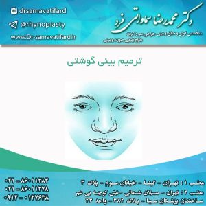 ترمیم بینی گوشتی 